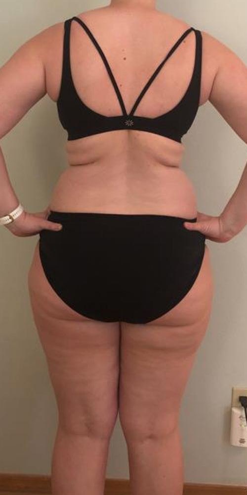Beth before, photo 2