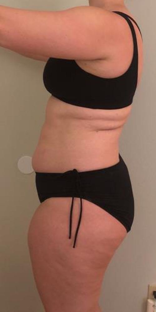 Beth before, photo 3