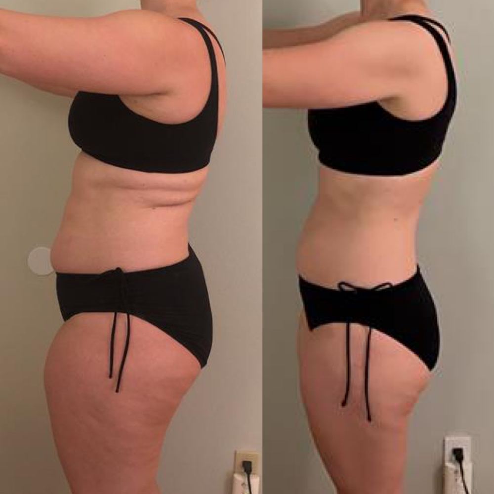 Beth before and after transformation, photo 3